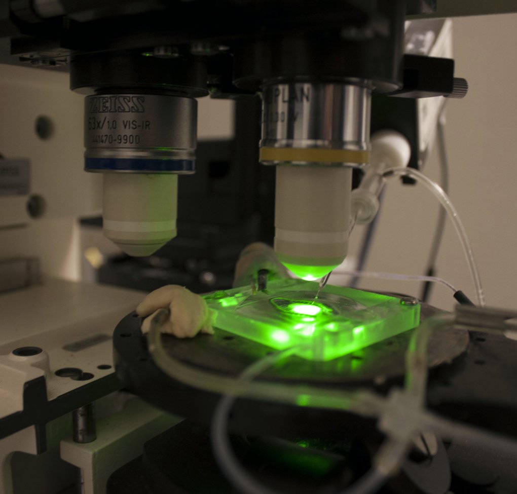 Electrophysiology system